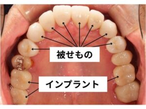 治療後の詳細症例画像