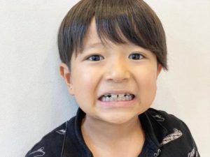 矯正を付けている男の子