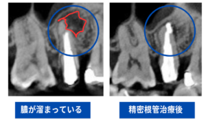 CT画像