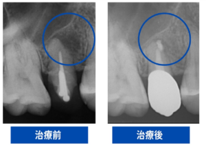 レントゲン画像