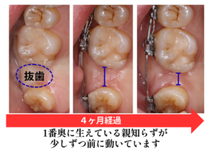治療の経過症例画像