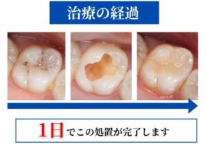 治療経過症例画像