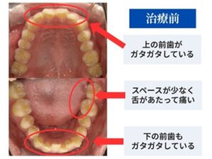 治療前の症例画像