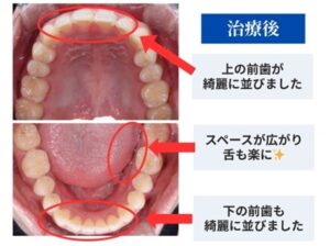 治療後の症例画像