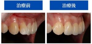 治療前後の症例画像