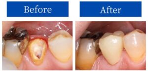 治療のBeforeAfter