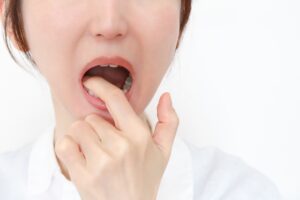歯に違和感がある女性