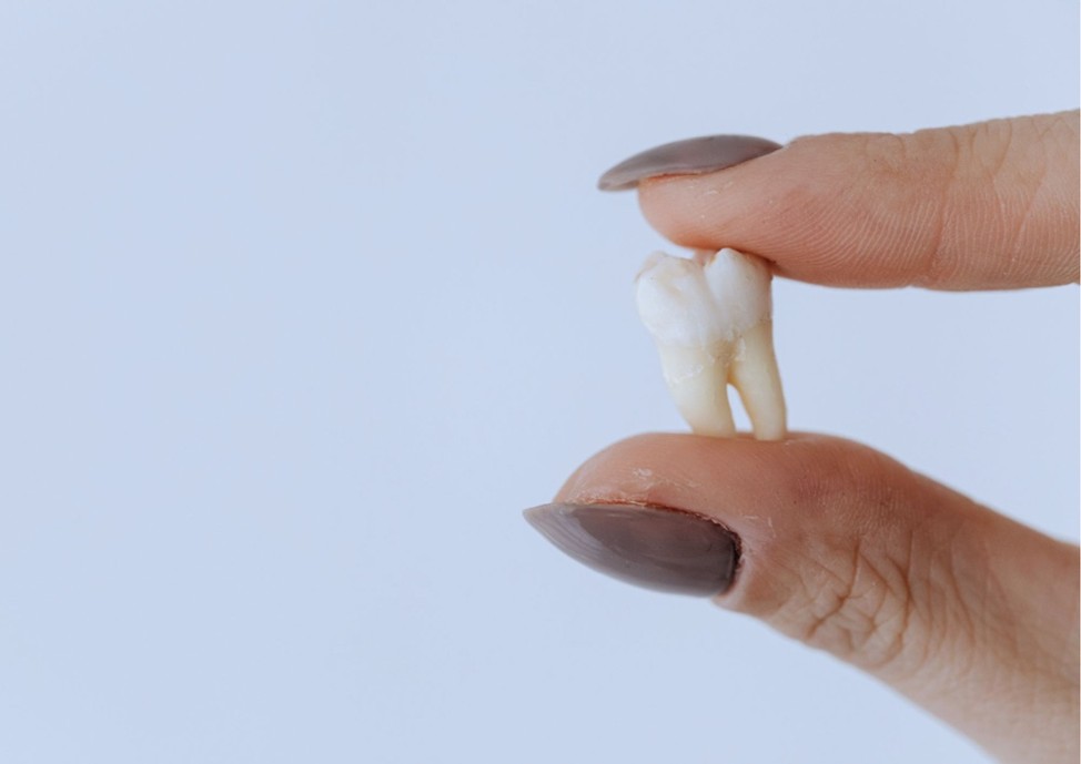 【症例紹介】上下総入れ歯（義歯）治療で噛む力と笑顔を取り戻す｜岡山市にある歯医者【政久歯科醫院】