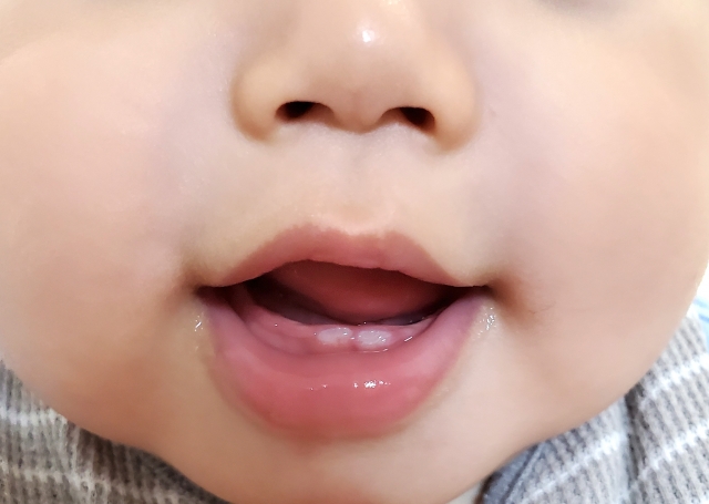 乳歯の生える順番と離乳食の関係 〜歯科衛生士ママが伝えたい「食べる力」の育て方〜｜岡山市にある歯医者【政久歯科醫院】